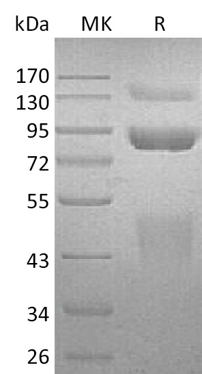 Human HGF R +SDS-PAGE-1.jpg
